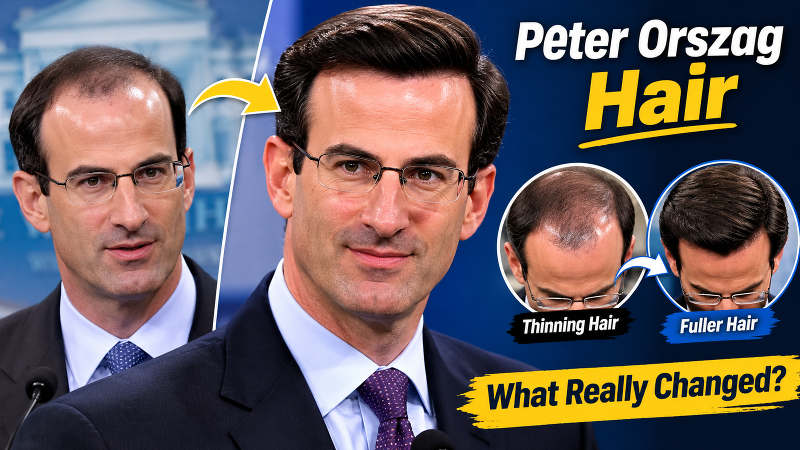 Peter Orszag Hair: Wig, Toupee or Real Hair?